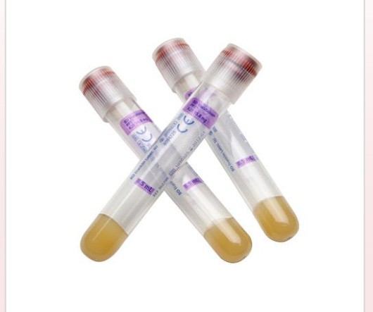 Vacutainer Tubes